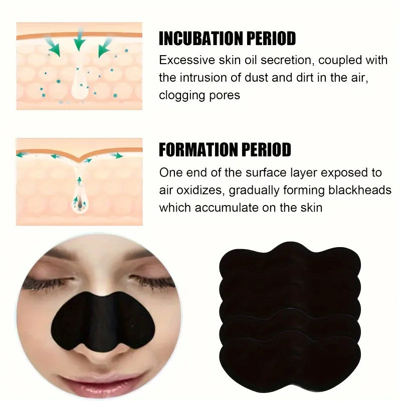 Blackhead remover