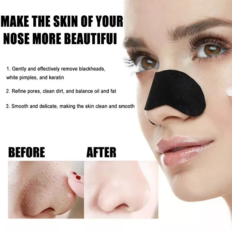 Blackhead remover